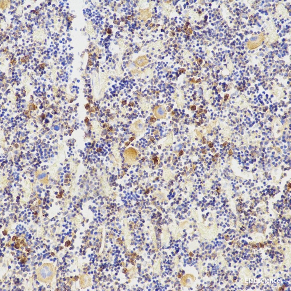 Immunohistochemistry analysis of paraffin-embedded mouse testis using SNAI1 Polyclonal Antibody at dilution of 1:600.