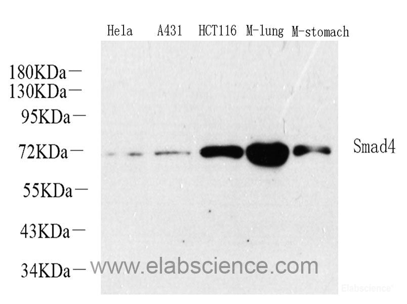 Western Blot analysis of various samples using GLUT-3 Polyclonal Antibody at dilution of 1:1000.