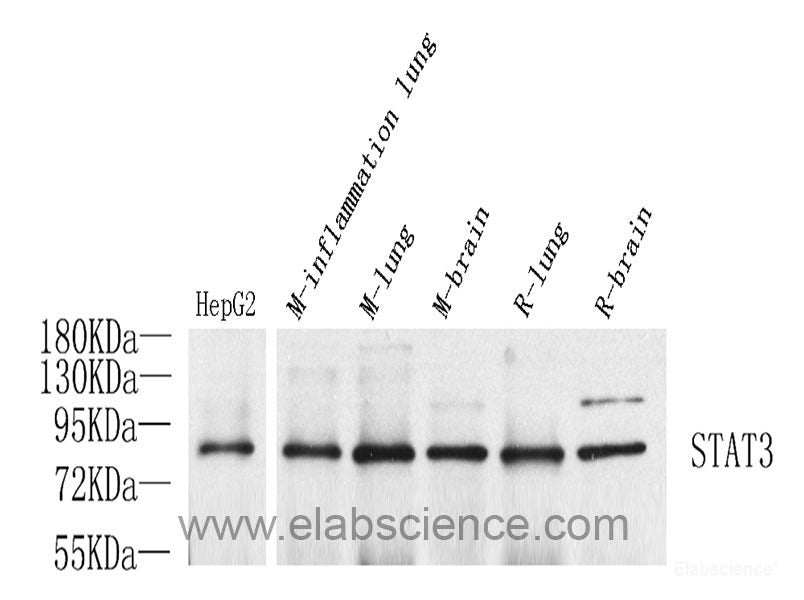 Western Blot analysis of various samples using CD163 Polyclonal Antibody at dilution of 1:1200.