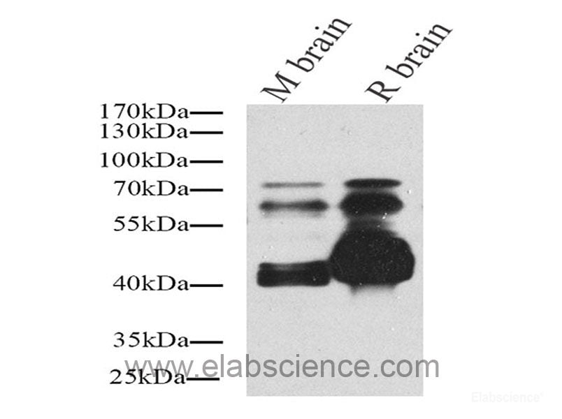 Immunohistochemistry analysis of paraffin-embedded mouse Inflammatory lung using Ly6g Polyclonal Antibody at dilution of 1:200.
