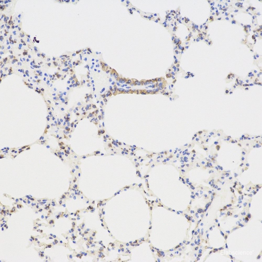 Immunohistochemistry analysis of paraffin-embedded mouse brain using CHAT Polyclonal Antibody at dilution of 1:300.