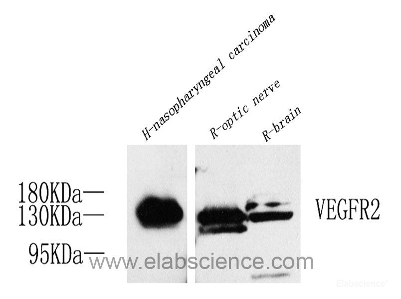 Western Blot analysis of various samples using ACE2 Polyclonal Antibody at dilution of 1:1000.