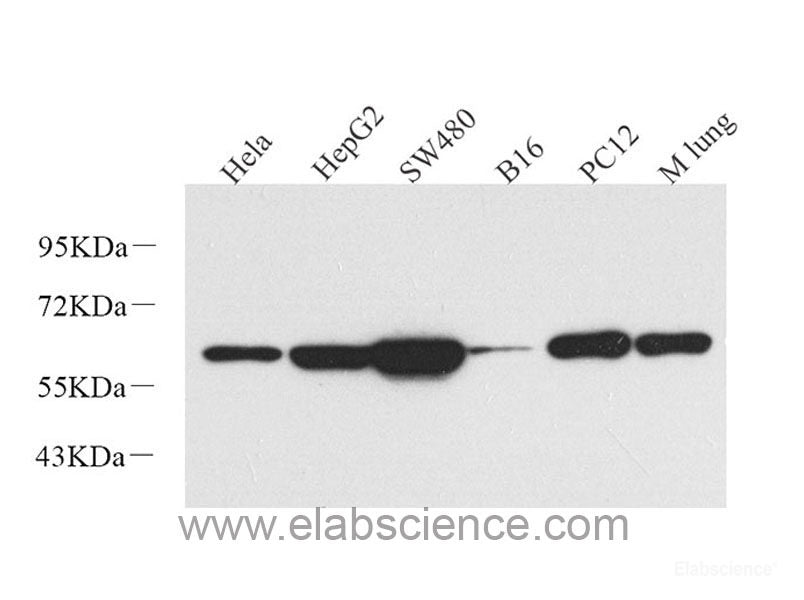 Western Blot analysis of various samples using p63 Polyclonal Antibody at dilution of 1:1000.