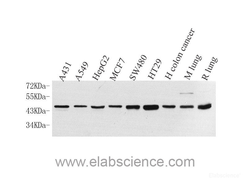 Immunohistochemistry analysis of paraffin-embedded mouse brain using ACHE Polyclonal Antibody at dilution of 1:300.