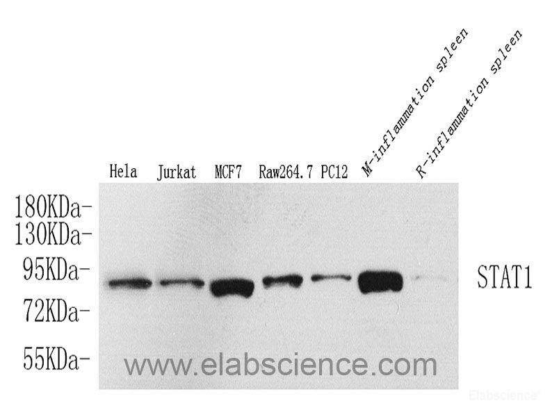 Immunohistochemistry analysis of paraffin-embedded human lung cancer using HDAC1 Polyclonal Antibody at dilution of 1:300.