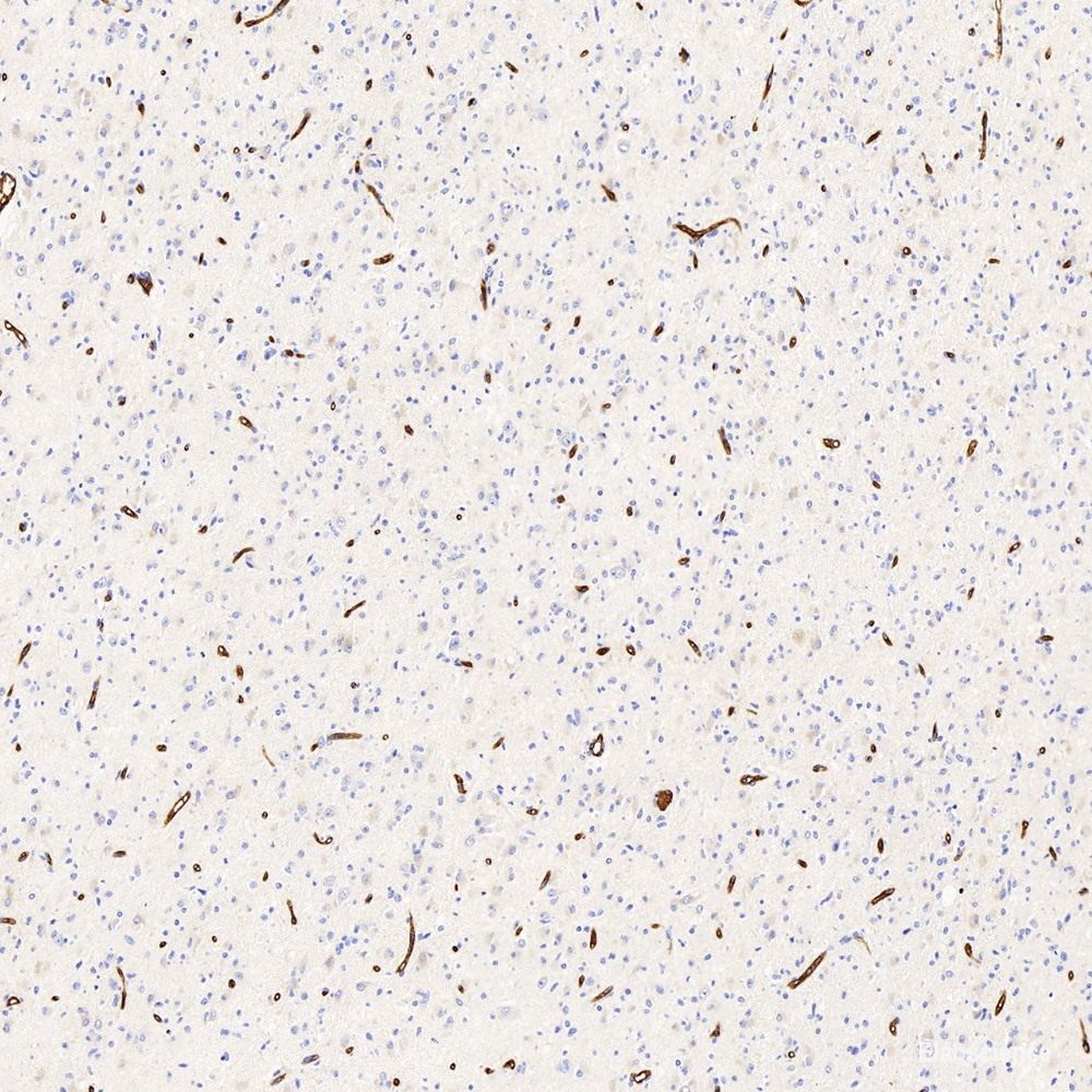 Western Blot analysis of various samples using DLG4 Polyclonal Antibody at dilution of 1:750.