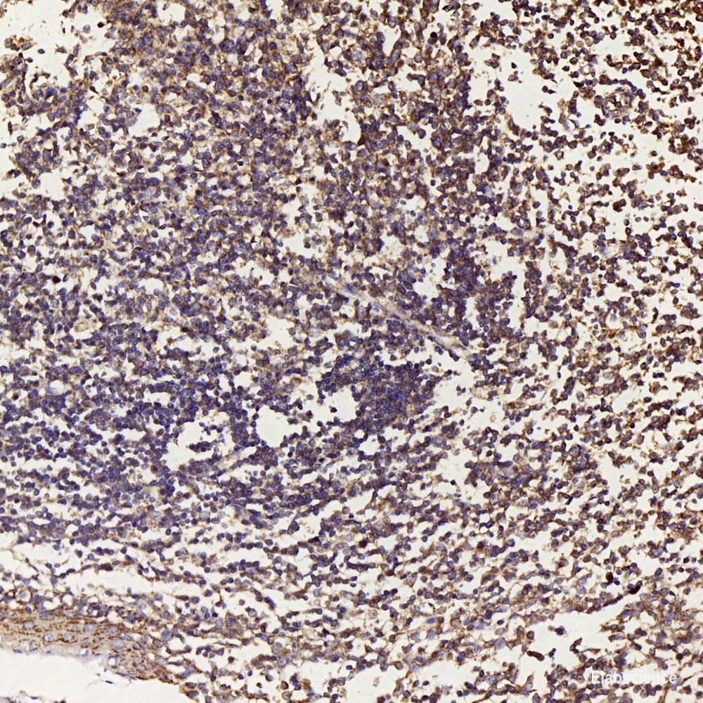 Immunohistochemistry analysis of paraffin-embedded rat heart using HES2 Polyclonal Antibody at dilution of 1:200.