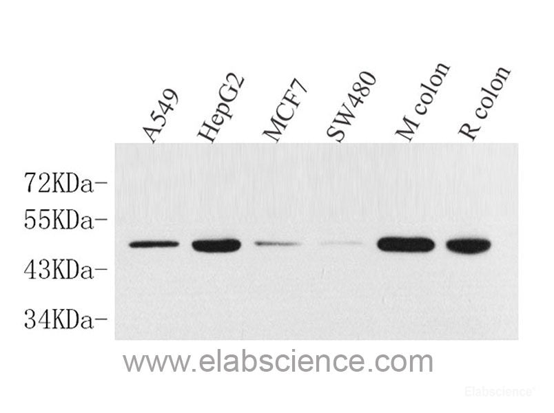Western Blot analysis of various samples using MBP Polyclonal Antibody at dilution of 1:1000.