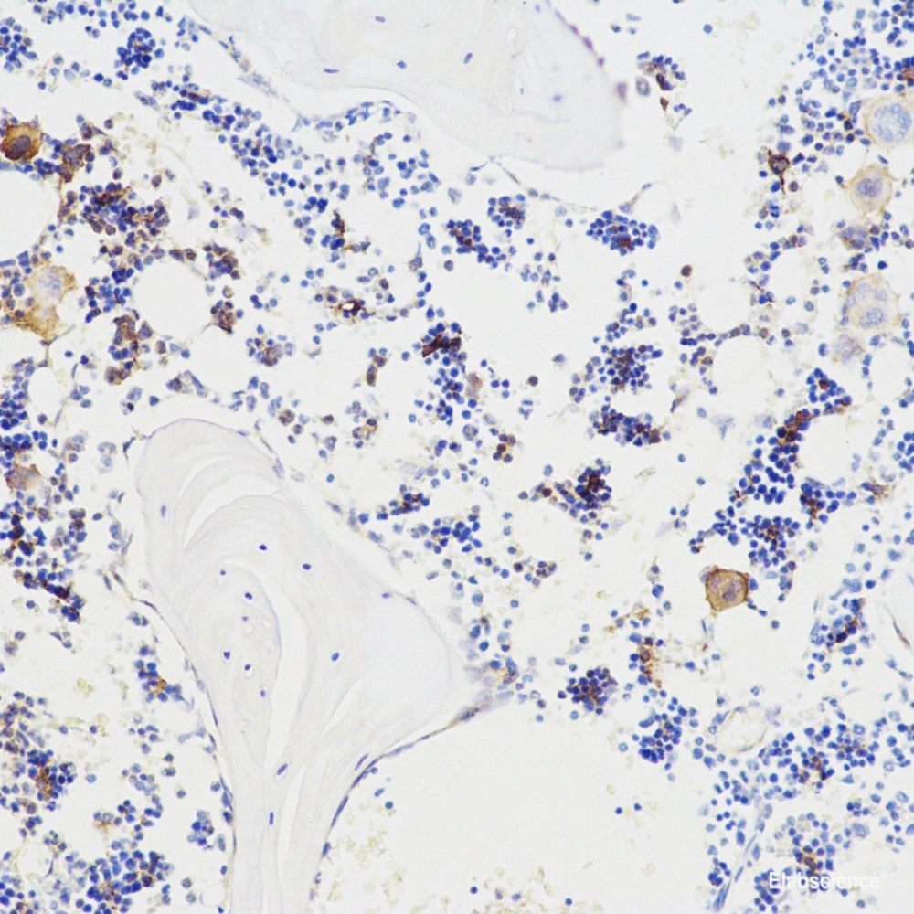 Immunohistochemistry analysis of paraffin-embedded human tonsil using ERK 2 Polyclonal Antibody at dilution of 1:100.