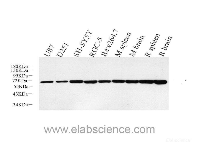 Western Blot analysis of various samples using c-Kit Polyclonal Antibody at dilution of 1:800.