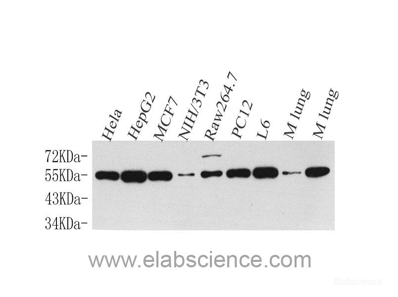 Immunohistochemistry analysis of paraffin-embedded mouse skeletal muscle using DLL4 Polyclonal Antibody at dilution of 1:200.