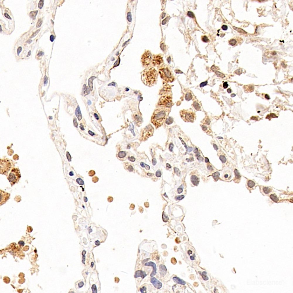 Immunohistochemistry analysis of paraffin-embedded mouse skin using MGMT Polyclonal Antibody at dilution of 1:300.