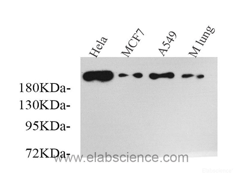 Western Blot analysis of various samples using ALB Polyclonal Antibody at dilution of 1:1000.