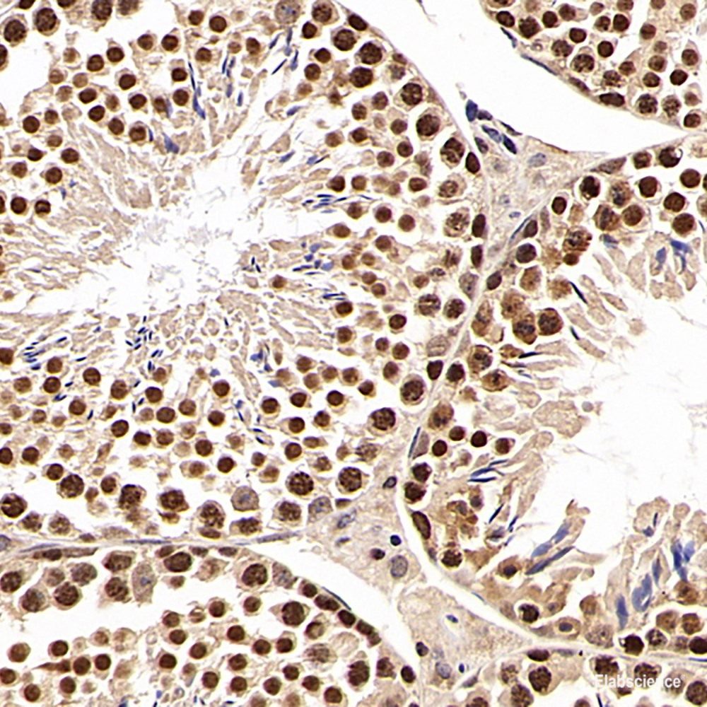 Immunohistochemistry analysis of paraffin-embedded human colon using MAP2K1 Polyclonal Antibody at dilution of 1:100.