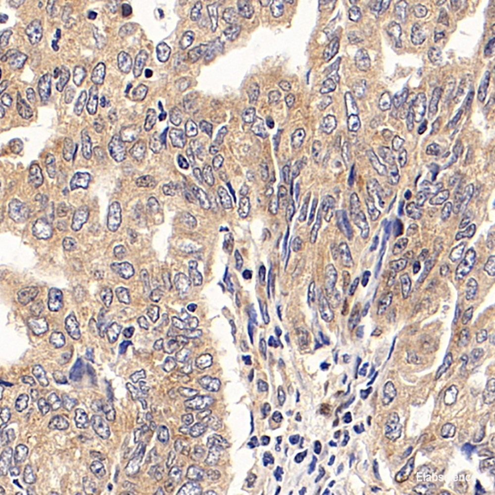 Immunohistochemistry analysis of paraffin-embedded human colon using LEP Polyclonal Antibody at dilution of 1:100.