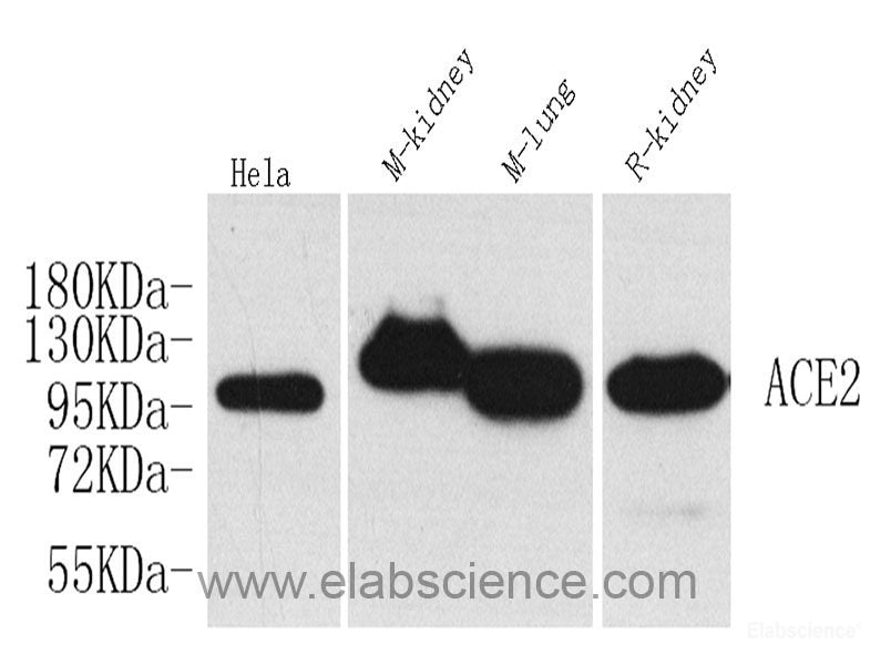 Western Blot analysis of various samples using SMAD2 Polyclonal Antibody at dilution of 1:750.
