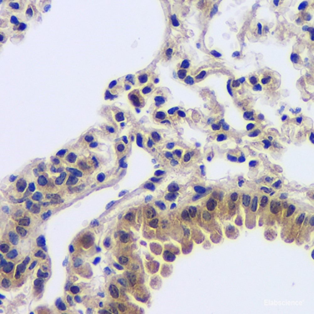 mmunohistochemistry analysis of paraffin-embedded mouse bone using MMP13 Polyclonal Antibody at dilution of 1:200.