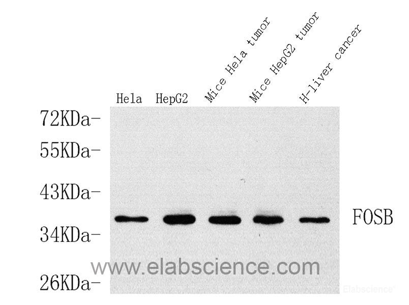 Immunohistochemistry analysis of paraffin-embedded Rat testis using ACE1 Polyclonal Antibody at dilution of 1:300.