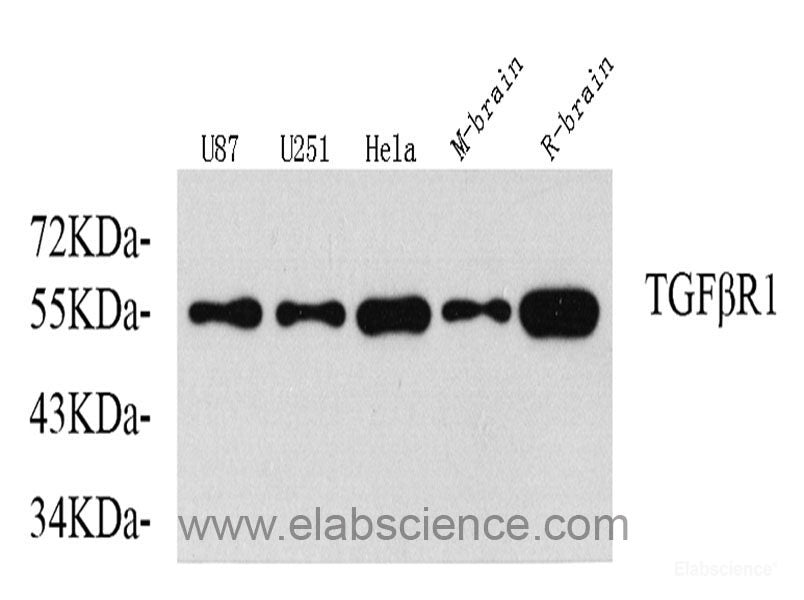 Western Blot analysis of various samples using ALPL Polyclonal Antibody at dilution of 1:1000.