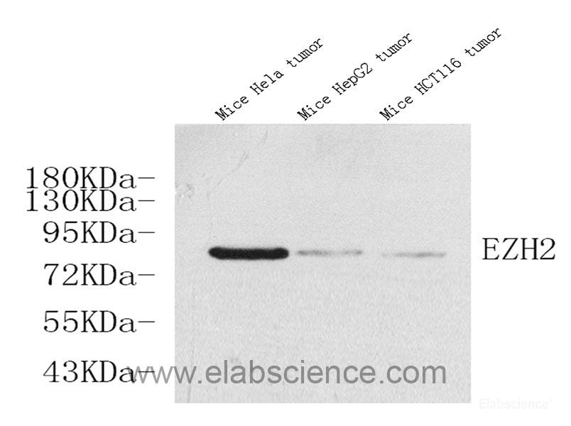 Immunohistochemistry analysis of paraffin-embedded mouse inflammatory lung using MMP9 Monoclonal Antibody at dilution of 1:400.