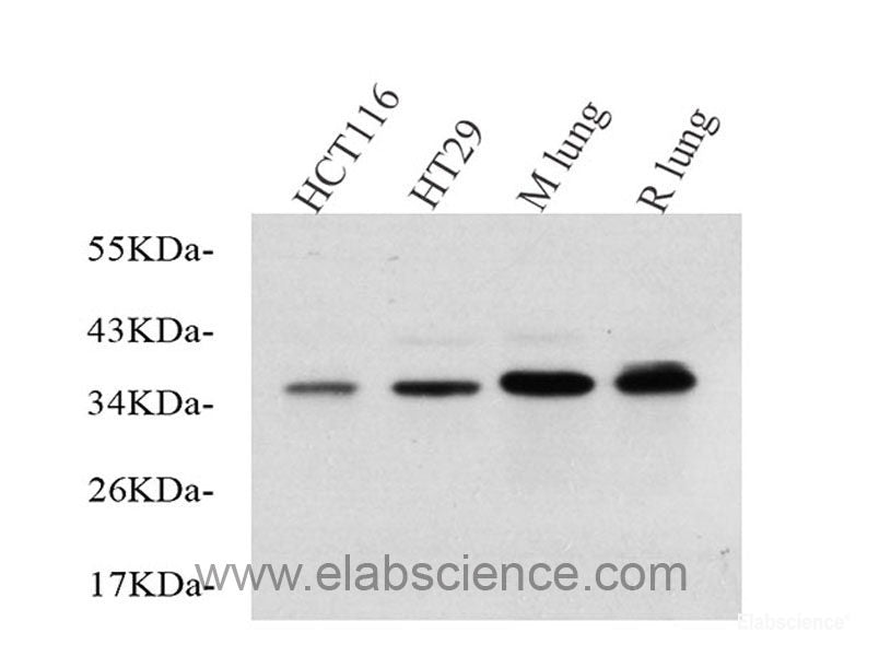 Western Blot analysis of various samples using CK-7 Monoclonal Antibody at dilution of 1:1000.