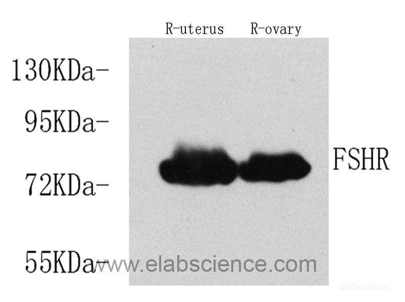 Immunohistochemistry analysis of paraffin-embedded rat bone using BMP2 Monoclonal Antibody at dilution of 1:400.
