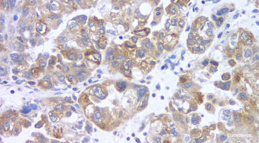 Immunohistochemistry analysis of paraffin-embedded mouse pneumonia using COX2 Polyclonal Antibody at dilution of 1:500.