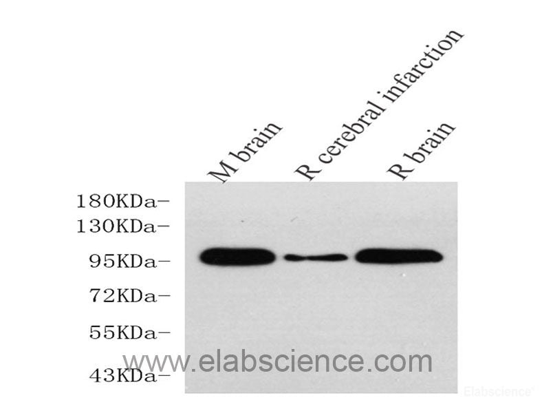 Immunohistochemistry analysis of paraffin-embedded human tonsil using BECN1 Polyclonal Antibody at dilution of 1:500.
