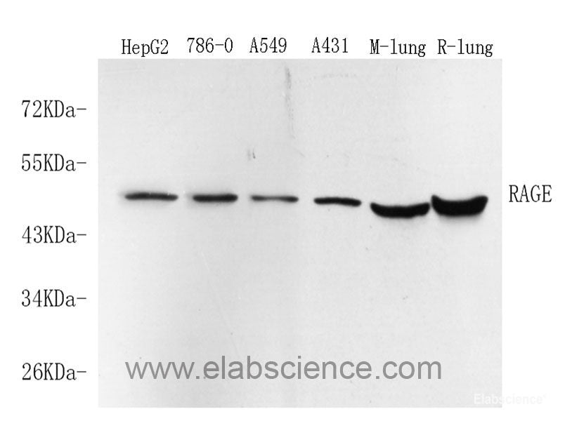 Immunohistochemistry analysis of paraffin-embedded mouse bone using COL2A1 Monoclonal Antibody at dilution of 1:400.