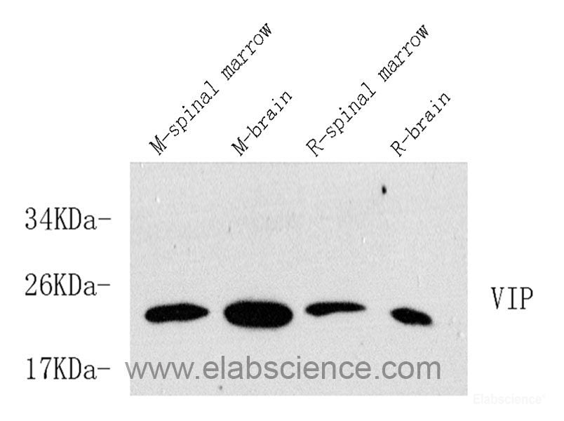Western Blot analysis of various samples using p19 INK4d Polyclonal Antibody at dilution of 1:500.