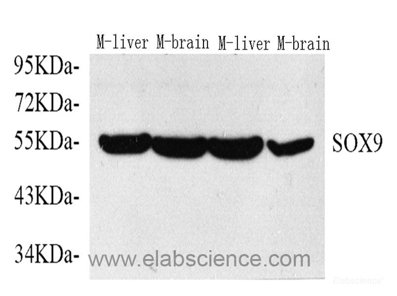 Western Blot analysis of various samples using CDK1 Polyclonal Antibody at dilution of 1:1000.