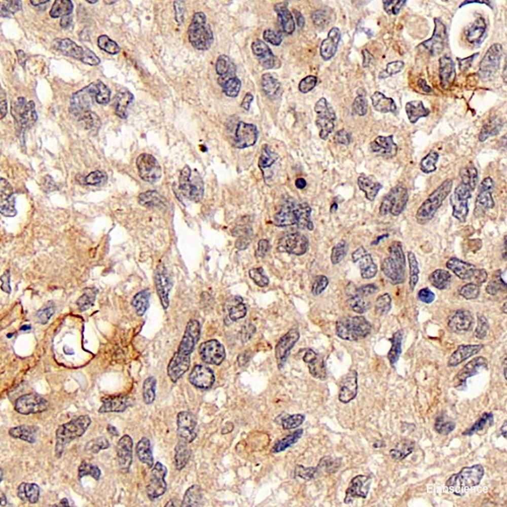 Immunohistochemistry analysis of paraffin-embedded human tonsil tissue using Galectin 3 Monoclonal Antibody at dilution of 1:400.