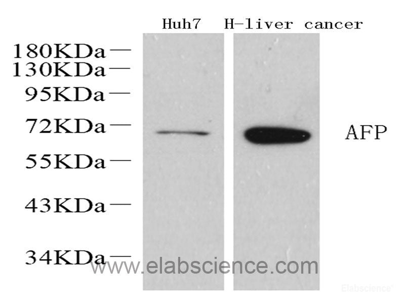 Western Blot analysis of various samples using Desmin Polyclonal Antibody at dilution of 1:1000.