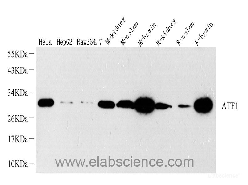 Western Blot analysis of various samples using STAT3 Monoclonal Antibody at dilution of 1:1500.