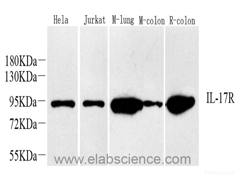Immunohistochemistry analysis of paraffin-embedded human tonsil using SIRT7 Polyclonal Antibody at dilution of 1:200.