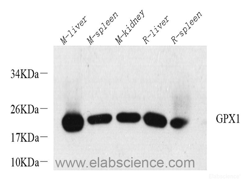Immunohistochemistry analysis of paraffin-embedded mouse brain using GRIN2B Polyclonal Antibody at dilution of 1:200.