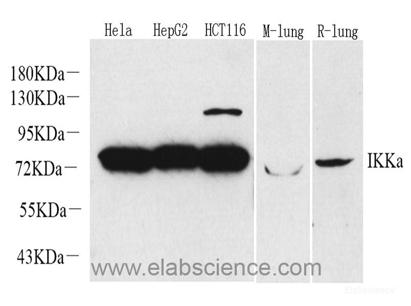 Western Blot analysis of various samples using COL3A1 Polyclonal Antibody at dilution of 1:750.