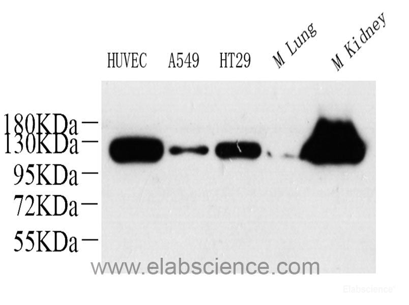 Immunohistochemistry analysis of paraffin-embedded mouse lungs using IL10 Polyclonal Antibody at dilution of 1:300.