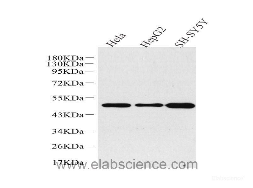 Western Blot analysis of various samples using TNNI3 Polyclonal Antibody at dilution of 1:600.