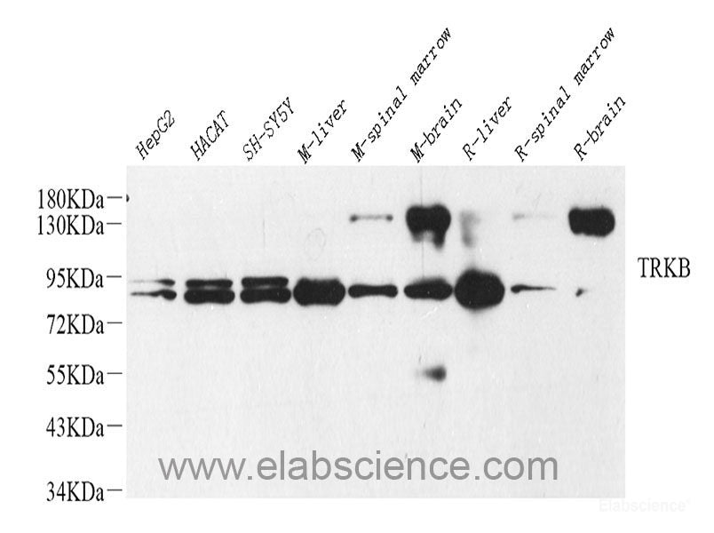 Immunohistochemistry analysis of paraffin-embedded human lung using CXCR7 Polyclonal Antibody at dilution of 1:100.