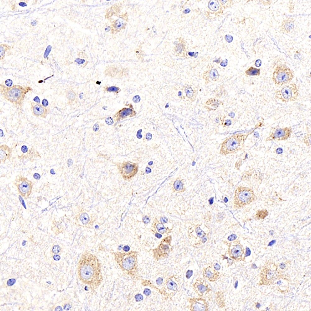 Immunohistochemistry analysis of paraffin-embedded mouse brain using beta Amyloid Polyclonal Antibody at dilution of 1:300.