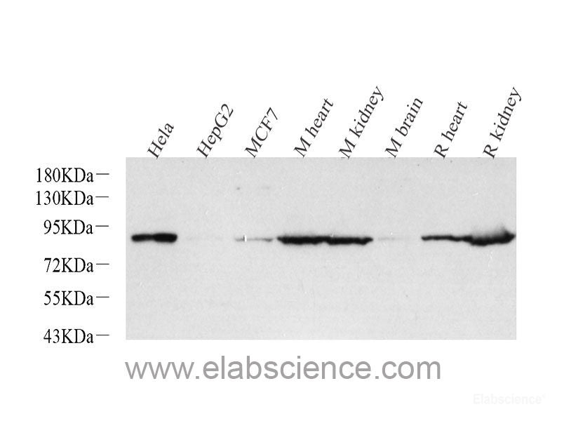 Immunohistochemistry (antigen was repair with 0.4% pepsin for 20 min) analysis of paraffin-embedded Mouse kidney using COL1A1 Polyclonal Antibody at dilution of 1:500.