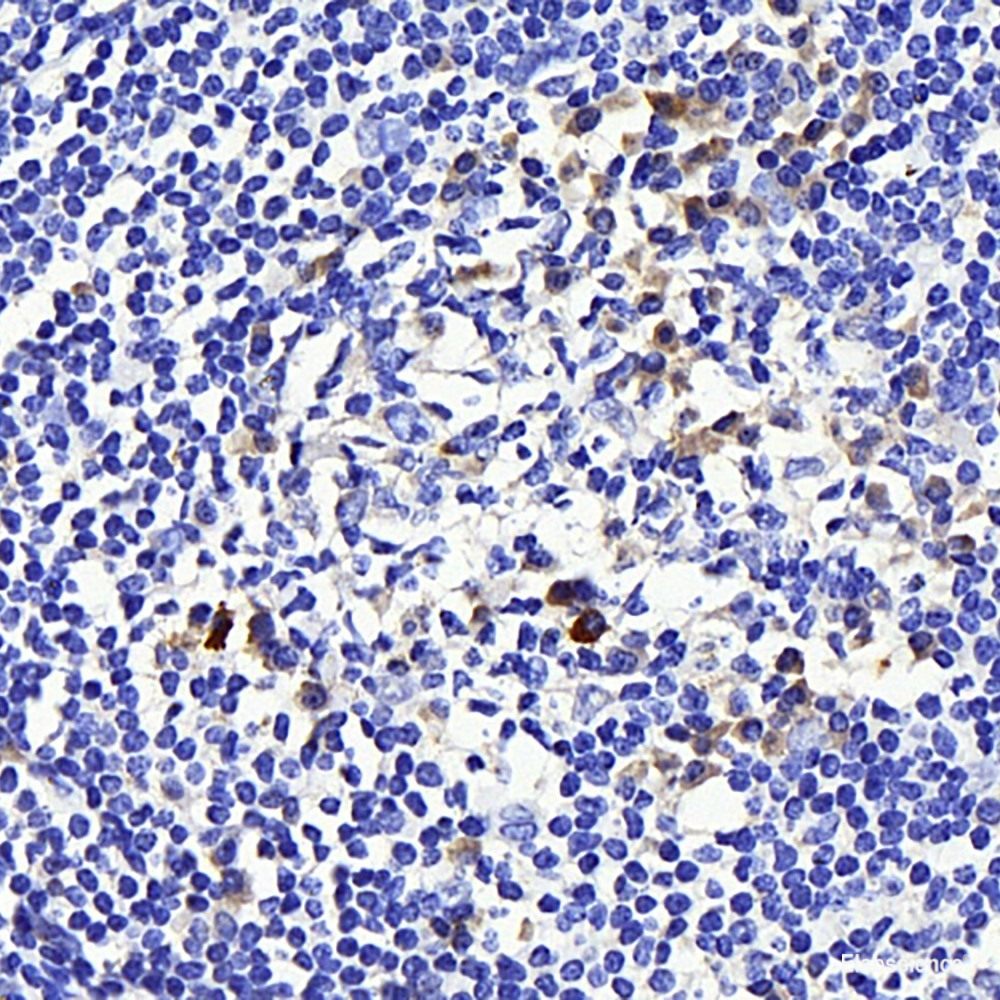 Immunohistochemistry analysis of paraffin-embedded mouse lung using MYD88 Polyclonal Antibody at dilution of 1:200.