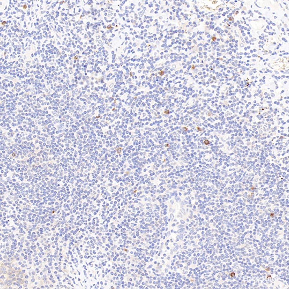 Western Blot analysis of various samples using ERK 2 Polyclonal Antibody at dilution of 1:800.