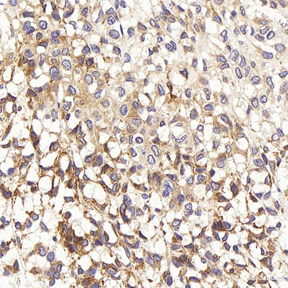 Immunohistochemistry analysis of paraffin-embedded mouse brain using MBP Polyclonal Antibody at dilution of 1:600.