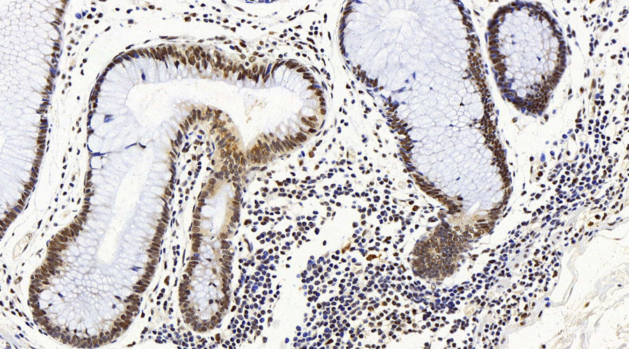 Immunohistochemistry analysis of paraffin-embedded mouse spleen using CD284 Monoclonal Antibody at dilution of 1:400.