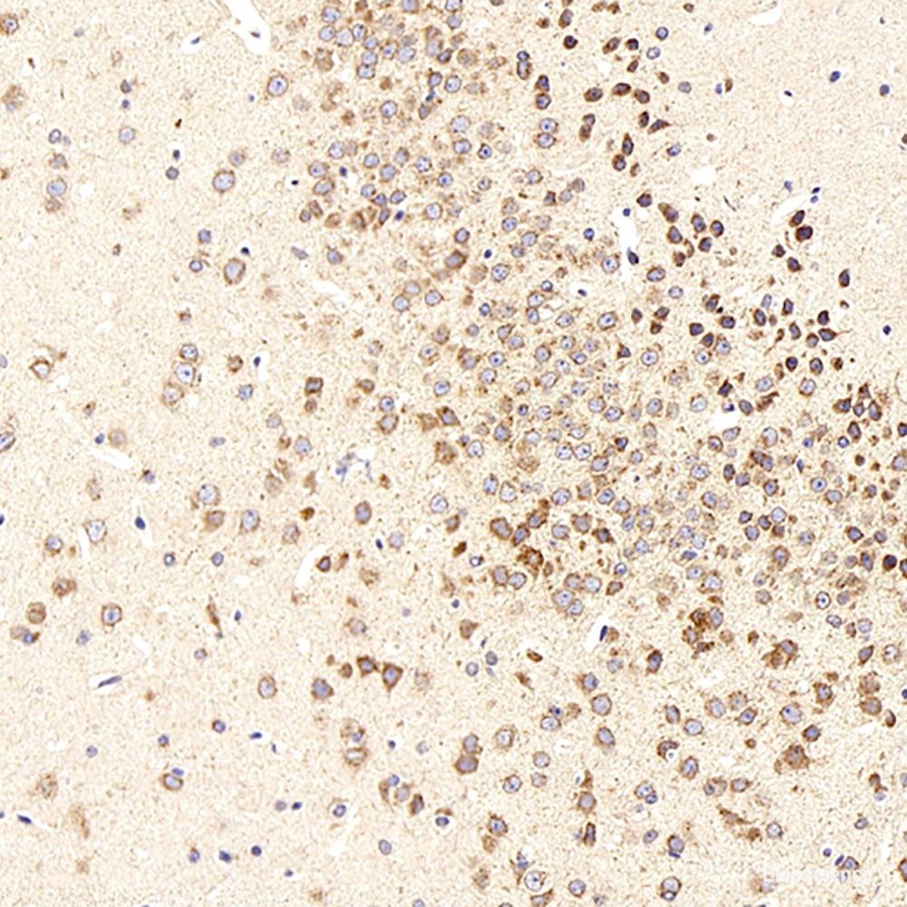 Immunohistochemistry analysis of paraffin-embedded human tonsil using Histone H4 Polyclonal Antibody at dilution of 1:400.