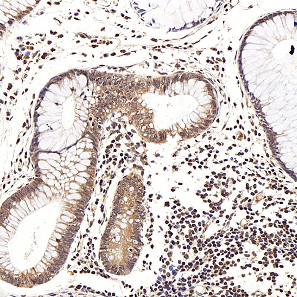 Immunohistochemistry analysis of paraffin-embedded mouse colon using RELB Polyclonal Antibody at dilution of 1:400.