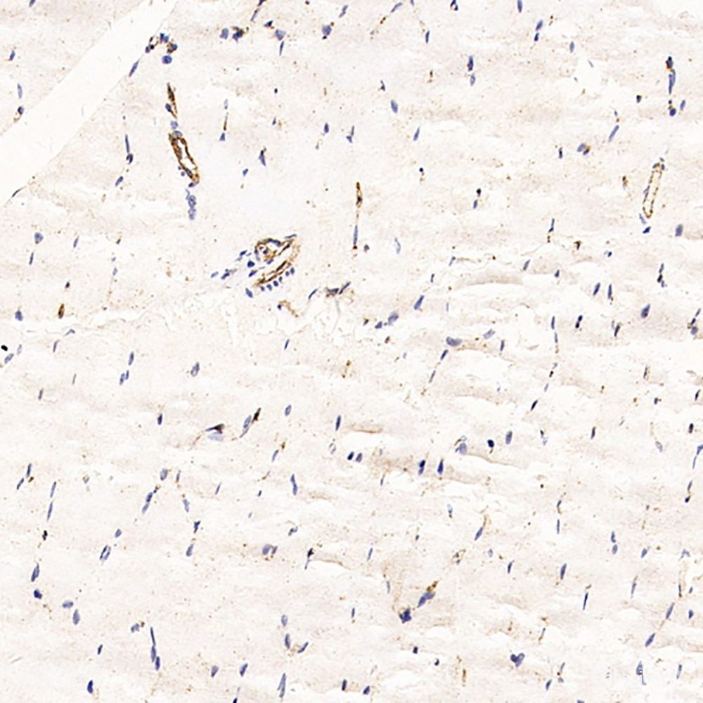 Western Blot analysis of various samples using AGT Polyclonal Antibody at dilution of 1:600.
