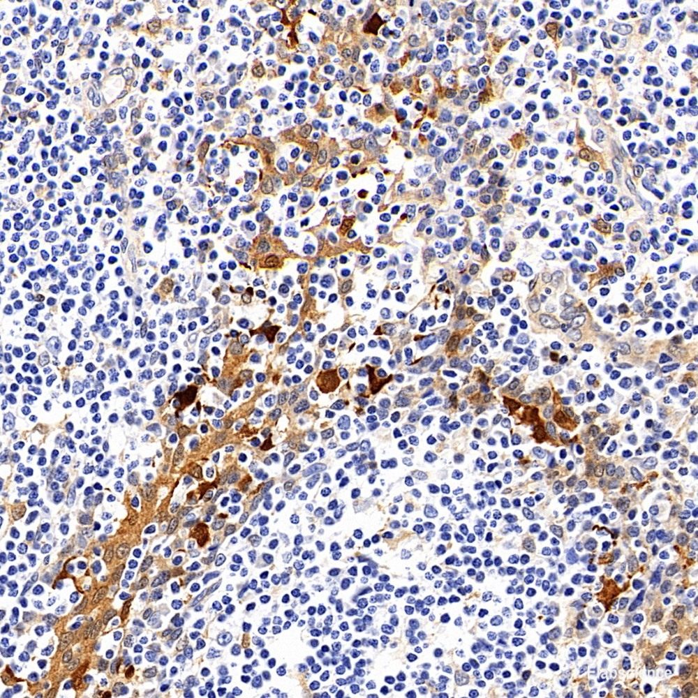 Western Blot analysis of various samples using HSP60 Polyclonal Antibody at dilution of 1:5000.